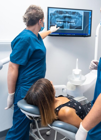 Full Arch Dental Implants Benefits