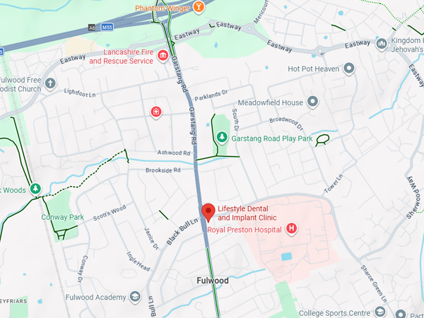 Smile Transformation