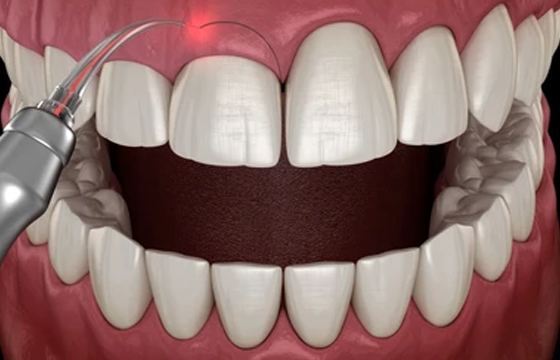 cosmetic dentist in Fulwood