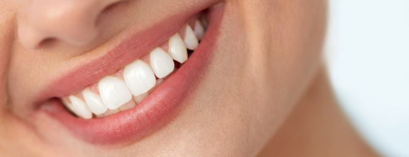 close up of a woman's smile after teeth whitening, with clear white teeth 