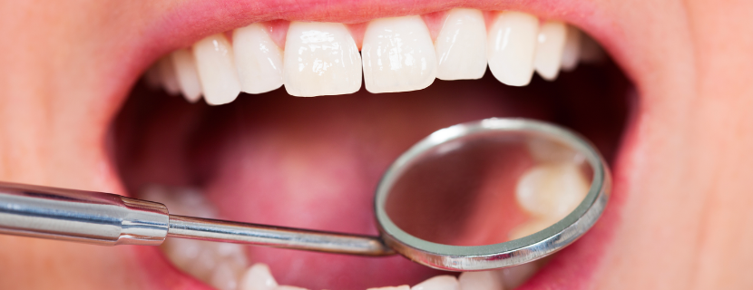 Close up image of white teeth with a magnifying glass looking at underneath molars