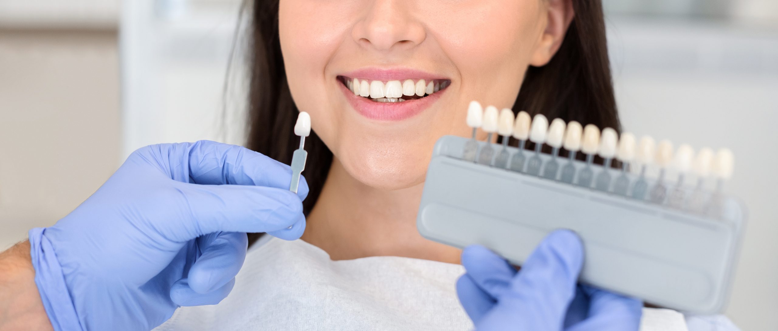 Dentist applying sample from tooth scale patient teeth for tooth whitening