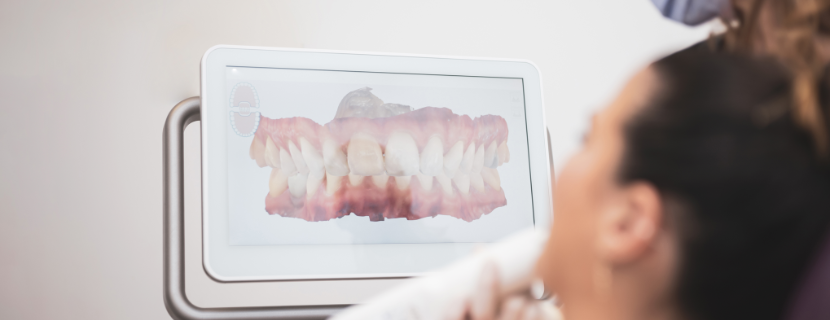 A close up image of a CT scanner scan of a digital smile and gums
