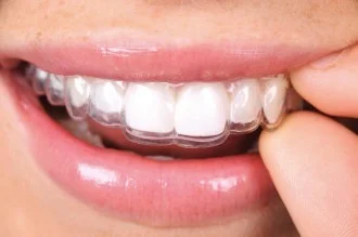 Braces Preston
